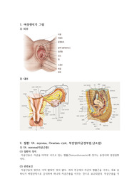 부인과 병동 선행학습(사전과제)_여성생식기_질환(Ut. myoma, Ovarian cyst, 부인암(자궁경부암,난소암))_검사 및 전.후 간호_수술(수술 전.후 간호 포함)_항암제의 정의 및 종류, 항암제 투여 시 주의사항_자궁경부암 환자의 방사선 치료