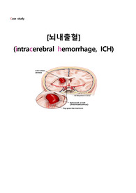 성인간호학 EICU(응급중환자실) Case Study - ICH(intracranial hemorrhage) [진단 2개]