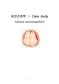 성인간호학 NSICU(신경외과중환자실) Case Study(케이스) - SDH(경막내혈종) [진단 2개]