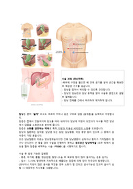 복강경 담낭절제술