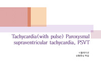 PSVT