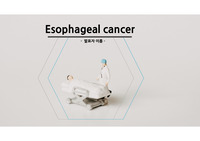 [간호] 식도암 케이스 스터디 (식도암, 식도절제술, 케이스, 수술 후 간호, PCA 비교)