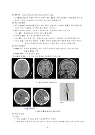 뇌내출혈 문헌고찰