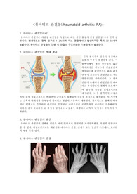 RA case study, 류마티스 관절염 케이스스터디, 간호진단&amp;과정 3개, 간호학, 간호학과, 간호사, 성인간호학