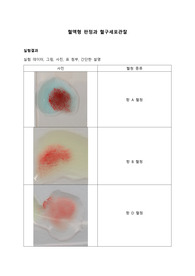 혈액형 판정과 혈구세포관찰_결과