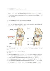 근위경골 절골술 HTO 수술