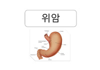 위암 수술적 치료
