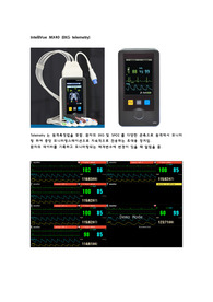 telemetry monitoring, 심전도 원격측정장치