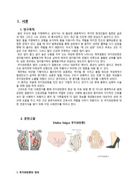 OS실습케이스_무지외반증_어깨수술