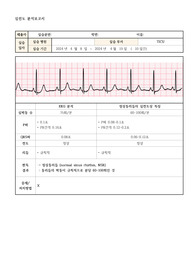 심전도 분석보고서 (정상동리듬, 2차방실차단)