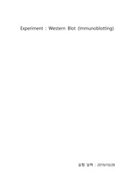 생화학 실험 레포트 - Western Blot (Immunoblotting)