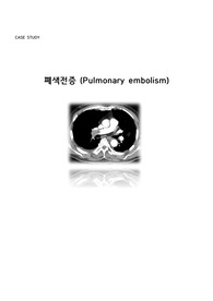 성인간호학) 폐색전증 case study  A+