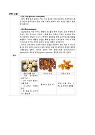 A++급성 담낭염 문헌고찰(참고문헌OK)