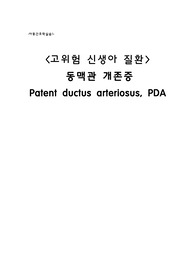 동맥관개존증 문헌레포트
