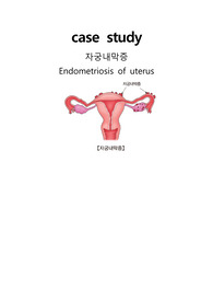 자궁내막증 케이스스터디