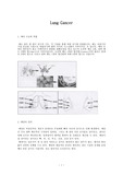 [간호학]폐암 케이스(lung cancer case)