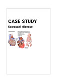[아동간호학]Kawasaki disease 문헌고찰,사정