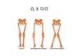 0 &amp; X 다리의 이해 및 운동 방법