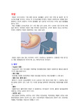 위암 대상자 간호(원인,임상증상,진단검사,치료,약물요법,방사선요법,수술요법,간호,합병증)