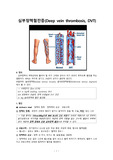 심부정맥혈전증(Deep vein thrombosis, DVT)