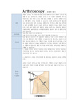 관절경 Arthroscopy 주제발표 정의 준비사항 적응증 검사시술시술방법 검사결과 주의사항 건강증진방법 검사 전후 간호