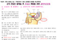성인간호학실습퇴원교육팜플렛-근치 전립샘 절제술 후 요실금 예방을 위한 골반저근운동(케겔운동)-A++